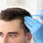 PRP Hair Fall Treatment in Vijayawada