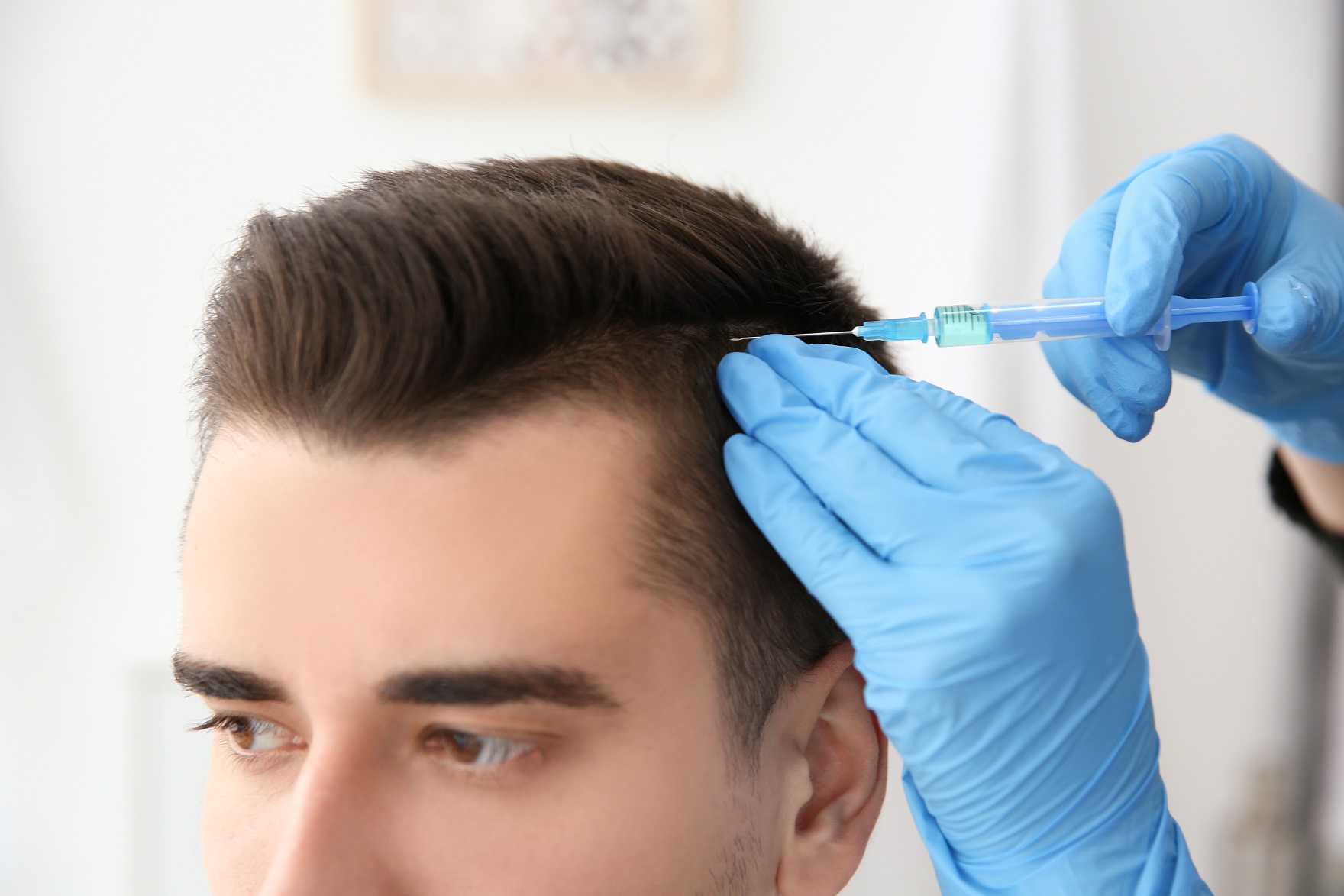 PRP Hair Fall Treatment in Vijayawada