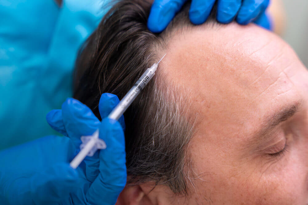 Best GFC Treatment In Vijayawada