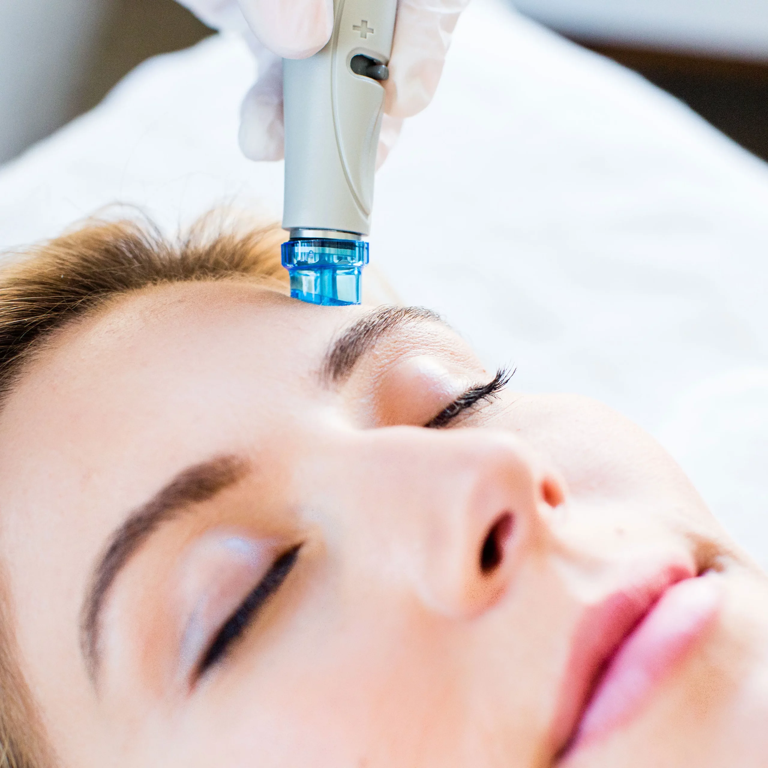Best Hydra Facial Treatment in Vijayawada