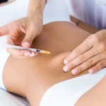 Best Liposuction Surgeon In Vijayawada