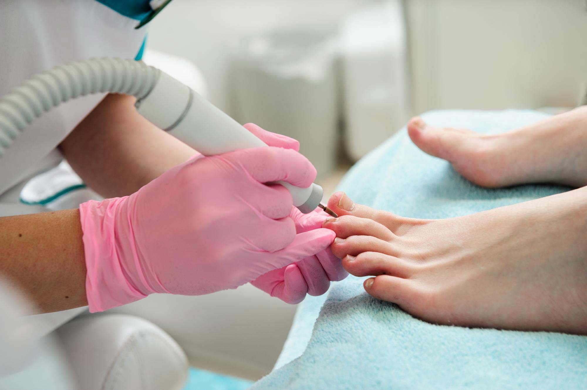 Best Nail Surgery In Vijayawada