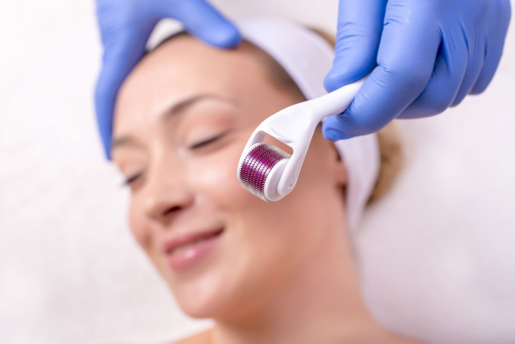Derma Roller And Fillers Therapy In Vijayawada