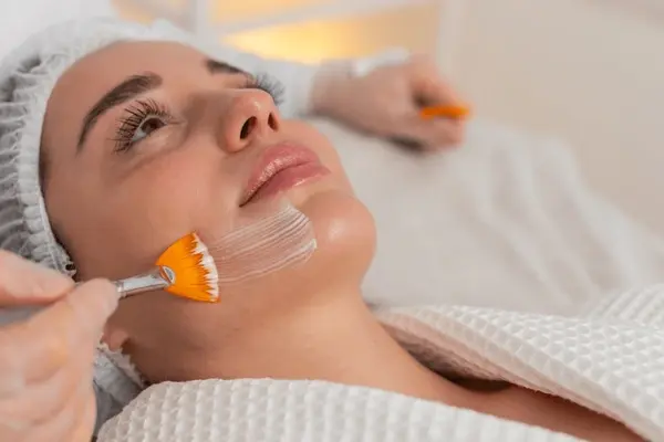 Chemical Peel Treatment in Vijayawada