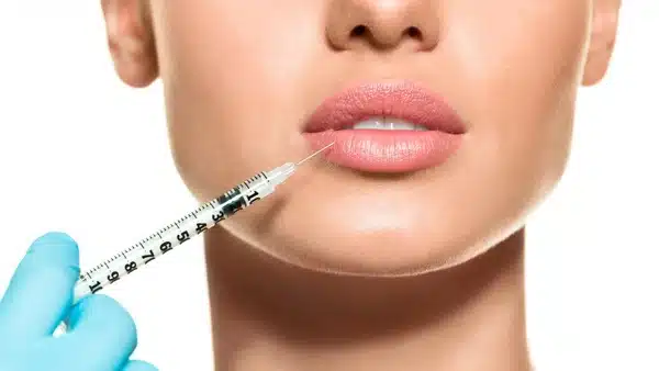 Lip Fillers in Vijayawada